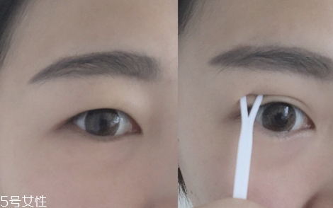 雙眼皮貼一般多少錢？