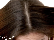 油性頭發(fā)跟什么有關(guān)？離不了這6個(gè)原因