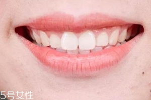 口紅病有哪些癥狀？使用不當(dāng)引發(fā)癌癥