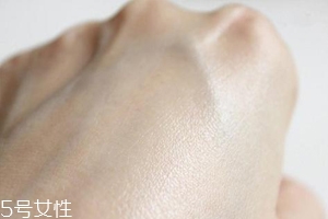 白癜風(fēng)與身體免疫功能有關(guān)系嗎？兩者關(guān)系密切