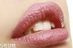 冬天爛嘴角什么原因？有可能營養(yǎng)不良