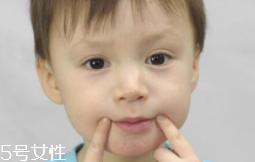 冬天爛嘴角什么原因？有可能營(yíng)養(yǎng)不良