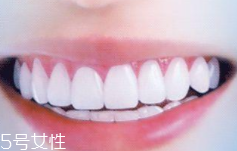 牙線和漱口水是否必要？抑菌護(hù)牙好習(xí)慣