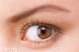 開眼角會影響視力嗎？開眼角會有危害