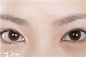 割雙眼皮后怎樣恢復(fù)快？女人不能割雙眼皮的時期