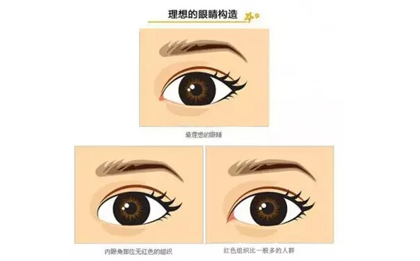 開外眼角和開內(nèi)眼角哪個好？開眼角有可能會回縮