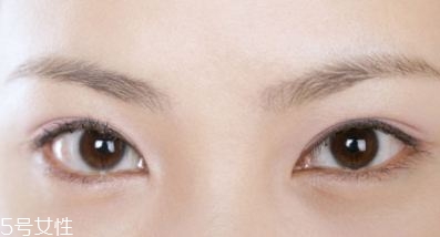割雙眼皮的術(shù)前準(zhǔn)備有哪些？割雙眼皮的常見做法