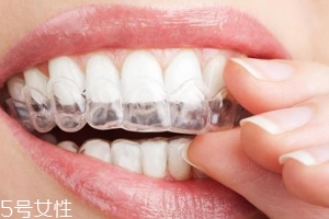 隱形牙套可以放餐巾紙上嗎？不衛(wèi)生