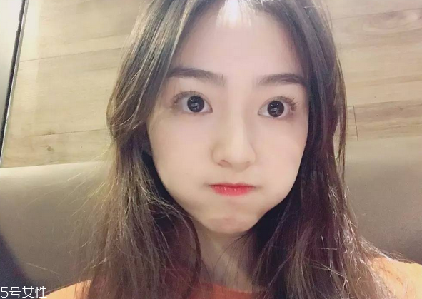 割雙眼皮要注意什么？割雙眼皮充血是正?，F(xiàn)象