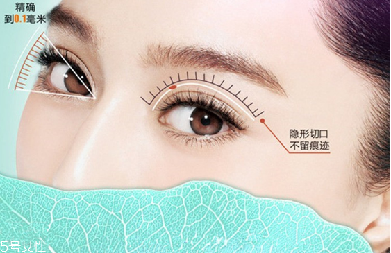 韓式雙眼皮是永久的嗎？圓眼睛不適合做雙眼皮
