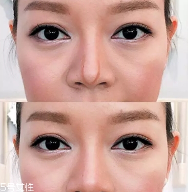 眉粉可以當(dāng)鼻影用嗎？眉粉這樣畫鼻影