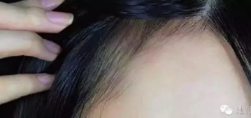 眉粉可以當發(fā)際線粉嗎？解救高發(fā)際線的技巧