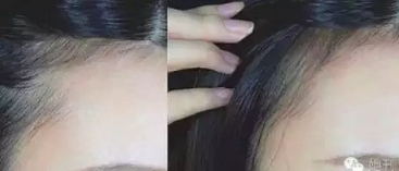眉粉可以當發(fā)際線粉嗎？解救高發(fā)際線的技巧