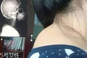 富貴包是什么?。孔藨B(tài)優(yōu)美少犯病