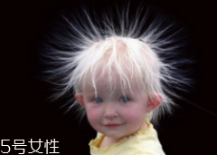 少年白什么原因？焦慮緊張會(huì)得病