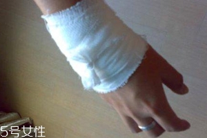 被蜈蚣咬傷后能治愈嗎？科學(xué)家有新發(fā)現(xiàn)