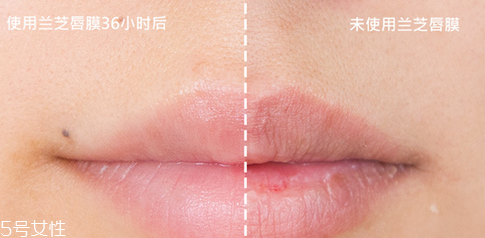 蘭芝唇膜吃進去怎么辦？擁有水嫩嘴唇