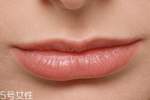 嘴唇干裂是一種病嗎？治療口角炎從改善習(xí)慣入手