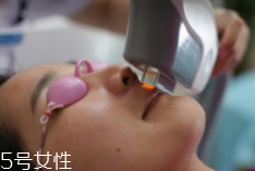 科技脫毛有哪些種類？冰點(diǎn)脫毛不毀毛囊