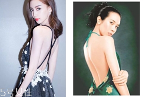 怎樣矯正背溝缺失？減肥運(yùn)動(dòng)是關(guān)鍵