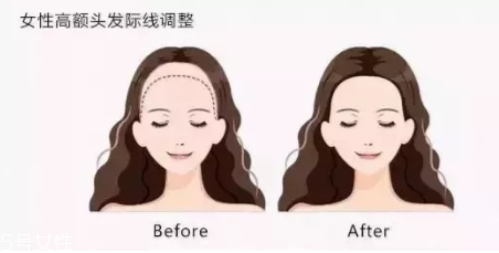 發(fā)際線粉填充和發(fā)際線筆哪個(gè)好？配合使用才最完美