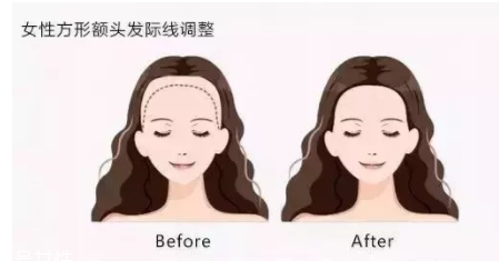 發(fā)際線粉填充和發(fā)際線筆哪個(gè)好？配合使用才最完美
