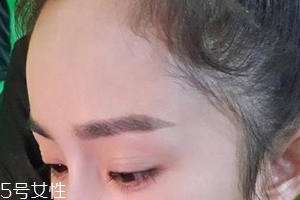 發(fā)際線高怎么治？拯救發(fā)際線攻略