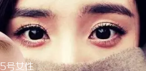 臥蠶和眼袋的區(qū)別是什么？臥蠶是肌肉眼袋是肥肉
