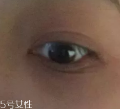 黑眼圈用什么眼霜好？多效護(hù)理型眼霜是首選
