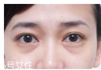 黑眼圈用什么眼霜好？多效護(hù)理型眼霜是首選