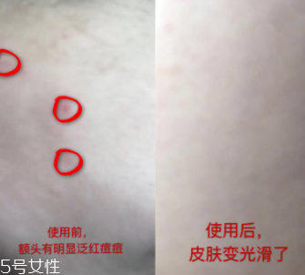 資生堂紅腰子適合什么年齡？最適合30歲以下人群
