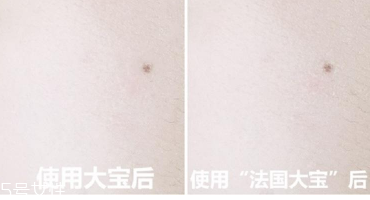 范爺同款法國大寶Embryolisse和大寶SOD蜜哪個(gè)好用？