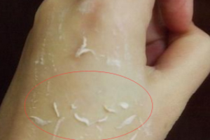 去角質(zhì)凝露多久用一次？皮厚一周一次