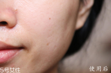 悅木之源和伊麗莎白雅頓哪個好？兩款精華大比拼