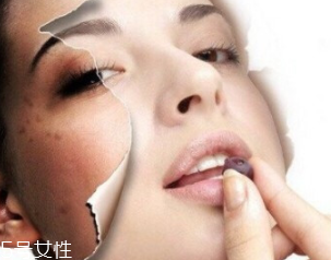 春季如何預(yù)防皮膚過(guò)敏？選擇敏感肌專用護(hù)膚品