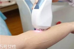 脫毛儀可以脫發(fā)際線嗎？脫了還會再長