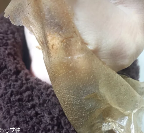 雪花秀撕拉面膜怎么撕出黑頭？這么做才能去黑頭
