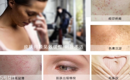德國krauterhof蝸牛精華膏效果怎么樣？