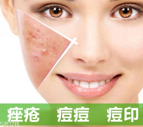 a酸是什么？a酸的功效與副作用
