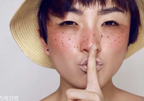 祛斑反彈是什么原因？一定沒注意這4點