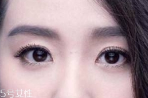 葉黃素會過敏嗎？一般不會的