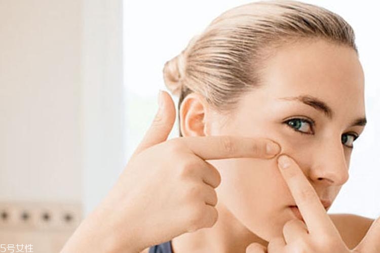 怎么痘痘不留疤痕 這么做讓痘印自動(dòng)離你而去 怎么痘痘不留疤痕 這么做讓痘印自動(dòng)離你而去