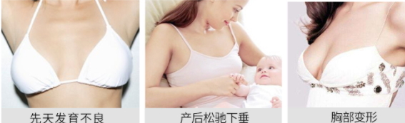 豐胸霜怎么用？豐胸霜使用手法詳解