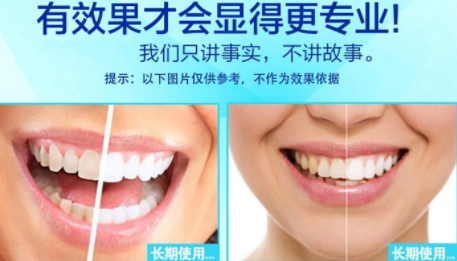 美白牙貼會(huì)反彈嗎？牙貼美白效果持續(xù)多久