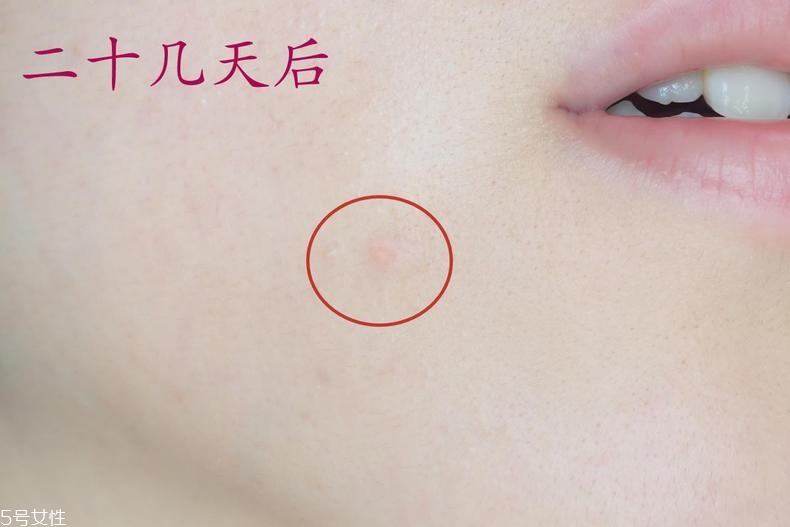 雅詩(shī)蘭黛晶透沁白防曬搖搖乳成膜快嗎？適合油痘皮嗎？