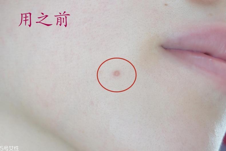 雅詩(shī)蘭黛晶透沁白防曬搖搖乳成膜快嗎？適合油痘皮嗎？