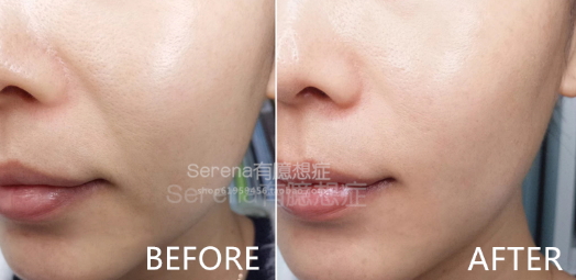 dermawand逆齡射頻注氧棒怎么用？