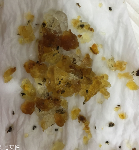 桃膠能和雞蛋一起吃嗎？桃膠配雞蛋可以嗎？
