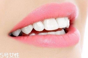 超聲波潔牙牙齒會(huì)變白嗎？超聲波潔牙心得