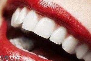 冷光美白會反彈嗎？冷光美白心得